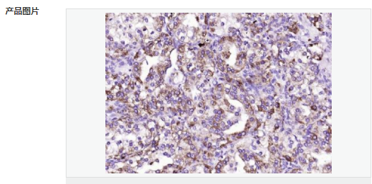 6052a744b1b0f.png image.png