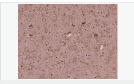 6054598249e4a.png image.png