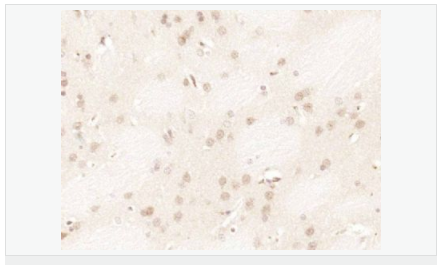 60584f376a966.png image.png